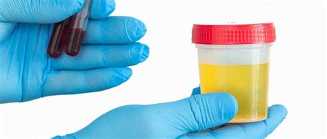 Using synthetic urine at labcorp. Things To Know About Using synthetic urine at labcorp. 